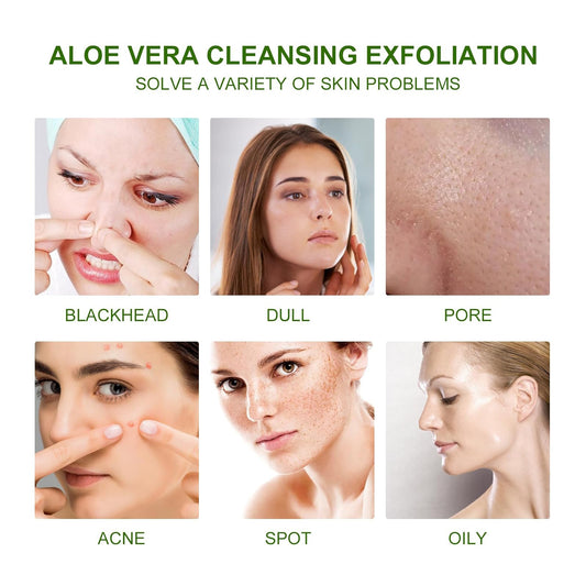 Aloe Vera Scrub For Deep Cleansing, Exfoliating And Smoothing Acne Marks, Soft Skin Scrub – Avaiya Gems